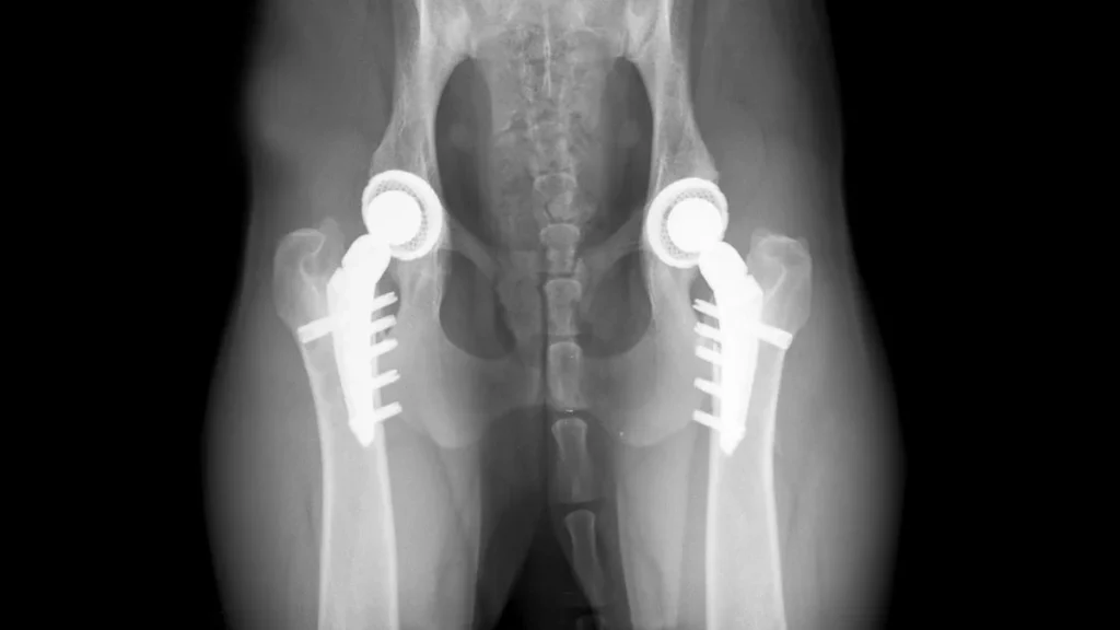 Radiografia medica che mostra una protesi articolare in titanio.