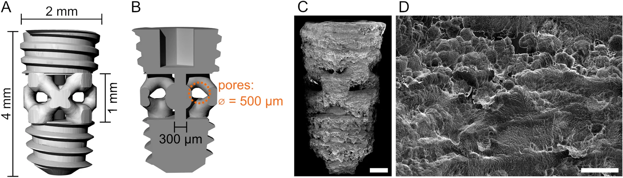 Why Titanium Is the Safest Metal for Medical Implants — And What "Biocompatible" Actually Means 3 SEM micrograph showing osseointegration at the titanium implant–bone interface — Springer Nature